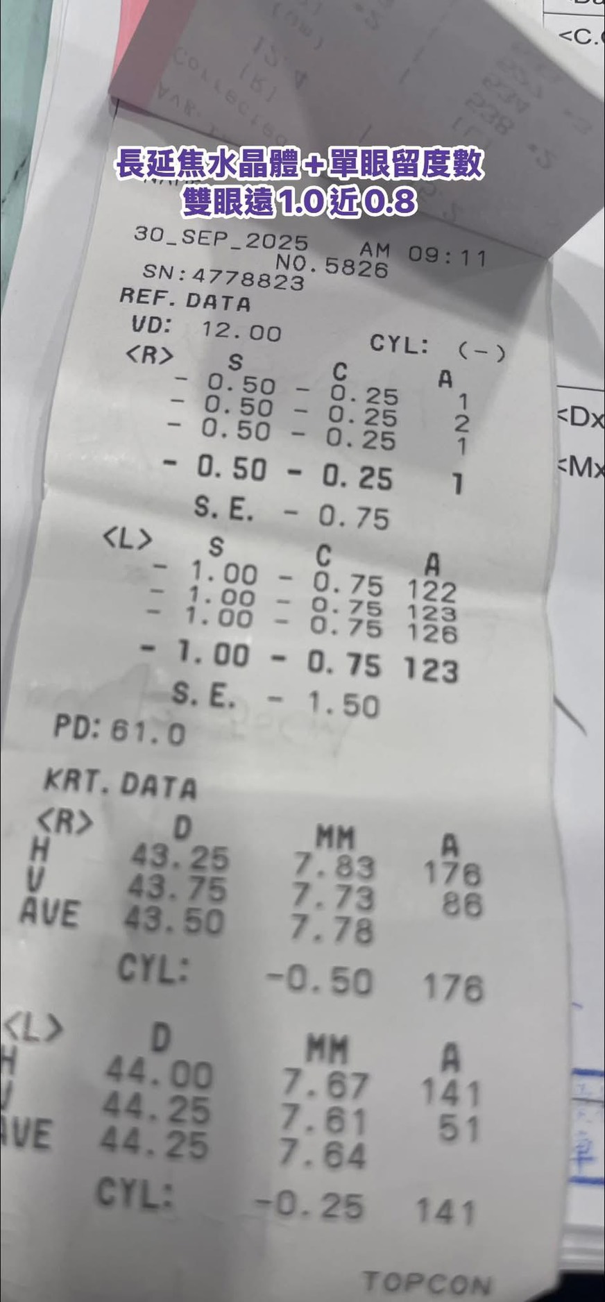 案例分享｜散光水晶體的穩定關鍵與白內障手術後的細節照護