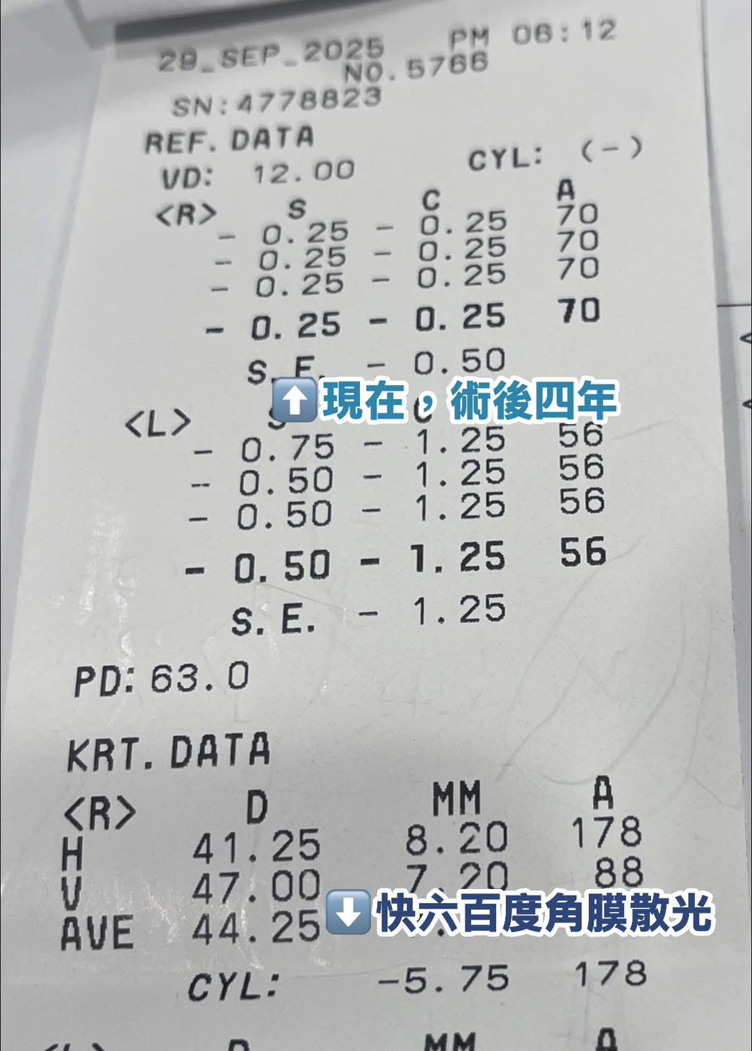 關於白內障的術前術後