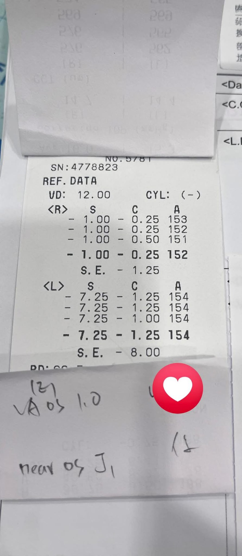 台南白內障案例分享｜年輕病人的長延焦選擇，讓視力與生活都更清晰