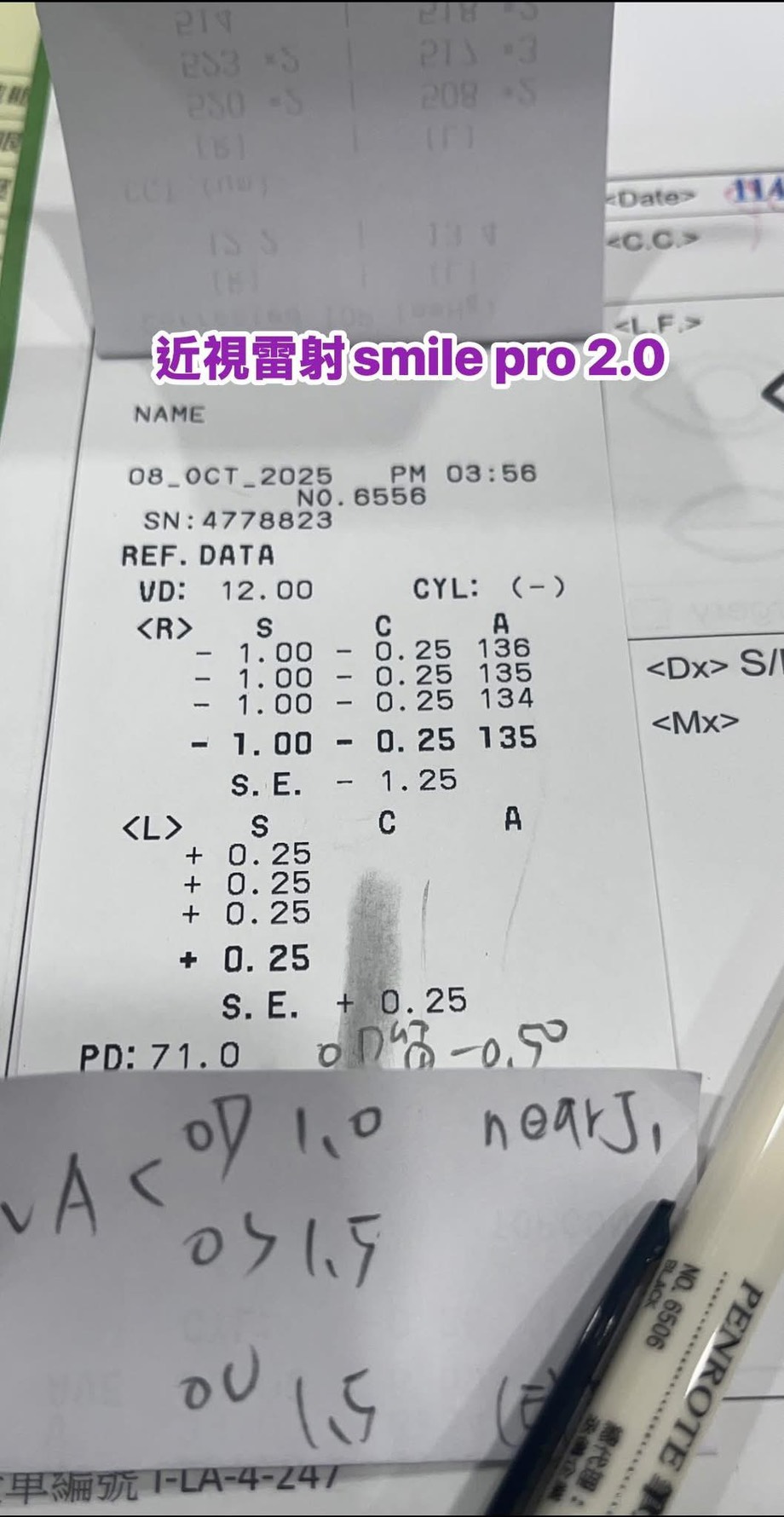 台南近視雷射案例分享｜41歲近視老花雷射，術後遠近視力一次到位
