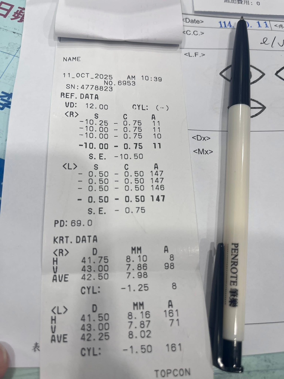年輕白內障案例照 1