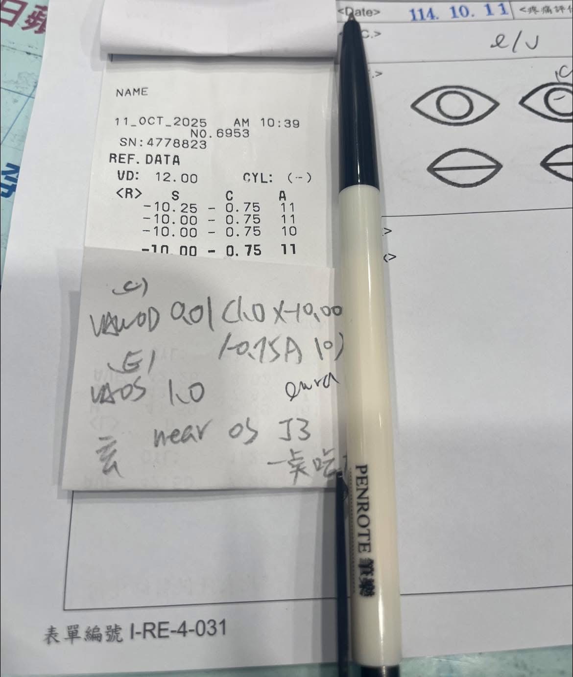 年輕白內障案例照 2