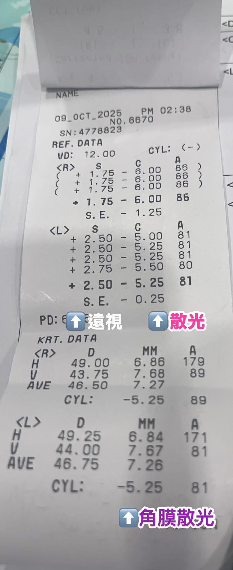 白內障健保片案例照 2