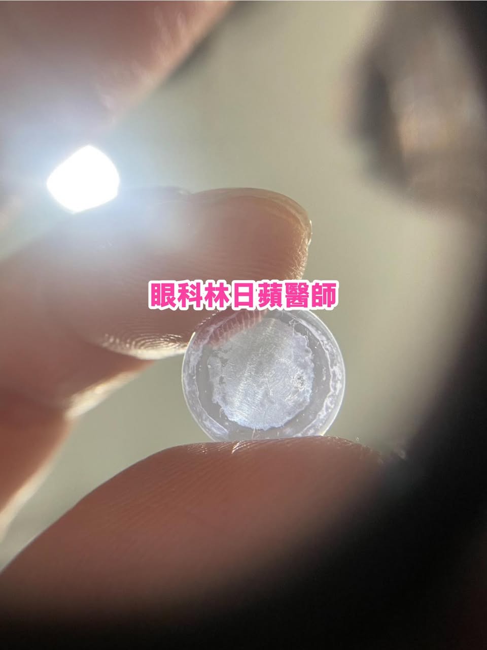 你家孩子的角膜塑形片，有定期帶回診所檢查嗎？